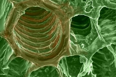 9b tulip flower stem ts a x3000 a xylem vessel colourised.jpg